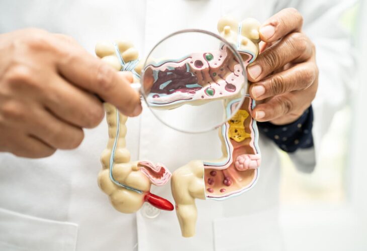 Doctor holding a model of the human colon and examining intestinal microbiota with a magnifying glass